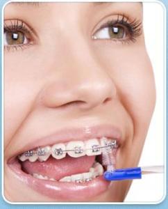 Orthodontists Melbourne